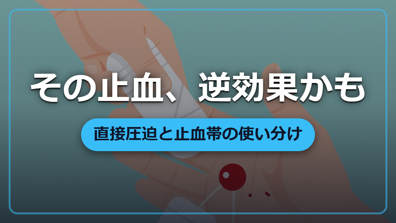 その止血、逆に危険かも ―― 直接圧迫と止血帯の正しい使い分け